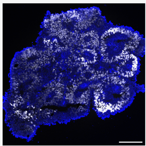 A mechanism controlling the genomic structure during early differentiation into neuroectoderm