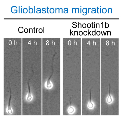 Identifying the Interactions That Drive Cell Migration in Brain Cancer