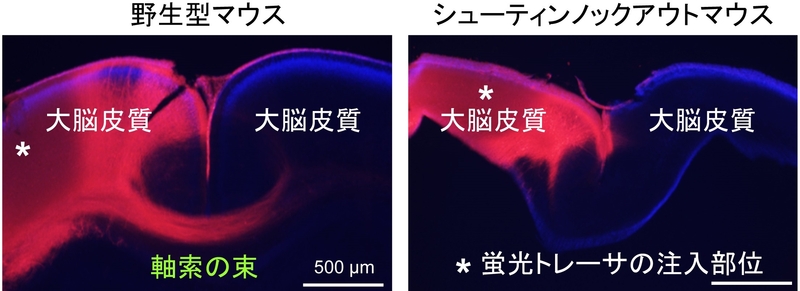 〔プレスリリース〕神経軸索が正しい方向に伸びる仕組みを解明 ～進路決定のための高感度ナビゲーターが明らかに～ 脳疾患の解明や再生医療への応用に期待