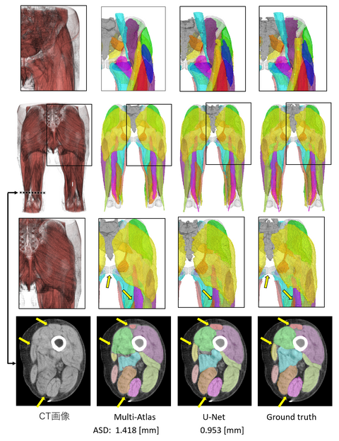 〔プレスリリース〕深層学習によるCT画像からの筋肉自動認識システムを開発 解析時間を大幅短縮、実用精度を達成 ～医学やスポーツ科学への応用期待～