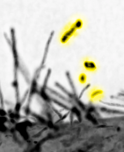 〔プレスリリース〕細胞間の情報伝達に関わる細胞外微粒子の新たな形成機構を解明 ～細胞膜の突起の切断により生成、細胞の移動を速める～