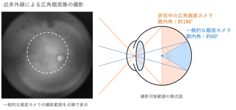 〔プレスリリース〕タムロン、奈良先端科学技術大学院大学と超広角眼底カメラを共同開発 広範囲180度の眼底撮影を可能にし、疾病の早期発見につなげる