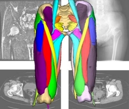 〔プレスリリース〕「けいはんなR&Dフェア2021」への出展について ＡＩによる医用画像からの人体筋骨格の解析 ～人生１００年時代、医用画像とＡＩ技術で、筋肉と骨の健康を守る！～